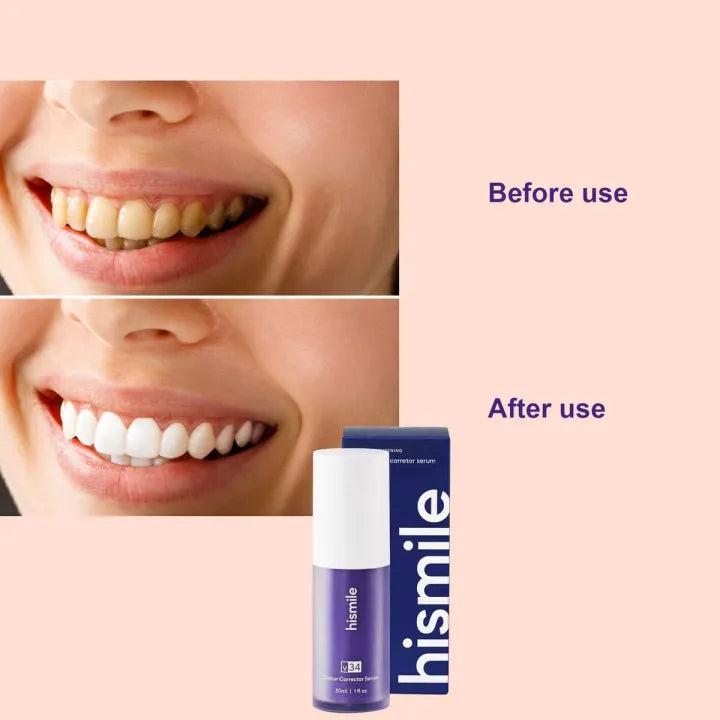 Hismile V34 Teeth Whitening Colour Corrector Serum 30ml