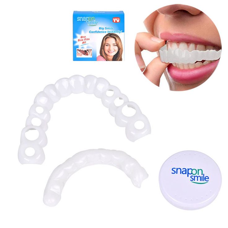 Snap-on Smile teeth