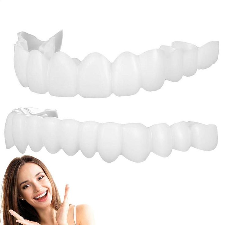 Snap-on Smile teeth